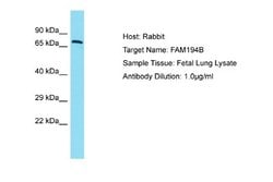 FAM194B Rabbit anti-Human, Polyclonal, Novus Biologicals 0.1ml; Unconjugated:Antibodies,